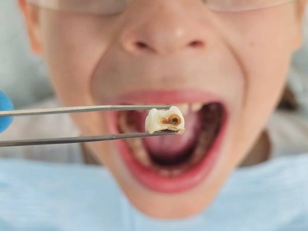 Emergency Dentist Open Today in MI
